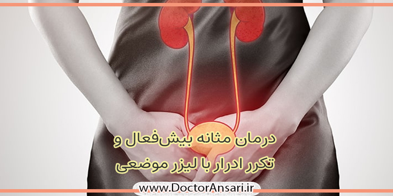 درمان مثانه پیش فعال