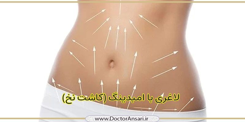 امبدینگ و لاغری